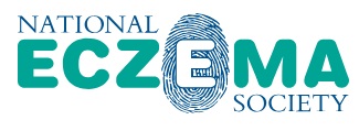 imagefile&photo=national_eczema_society_3703e71299abb82e6c786e167bfb7ee8.jpg